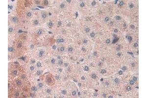 anti-Mannan-Binding Lectin serine Peptidase 2 (MASP2) (AA 445-683) antibody