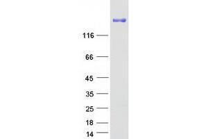 Validation with Western Blot