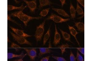 Immunofluorescence analysis of L929 cells using AGR2 Polyclonal Antibody at dilution of 1:100. (AGR2 anticorps)