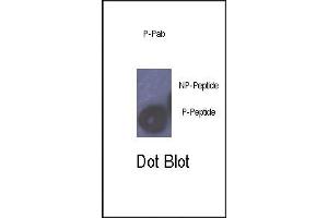 Dot blot analysis of anti-Phospho-Rb- Antibody (ABIN389644 and ABIN2839636) on nitrocellulose membrane. (Retinoblastoma 1 anticorps  (pSer780))