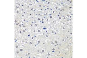 Immunohistochemistry of paraffin-embedded rat liver using CTCF antibody (ABIN6130043, ABIN6139180, ABIN6139182 and ABIN6217207) at dilution of 1:200 (40x lens). (CTCF anticorps  (AA 1-260))