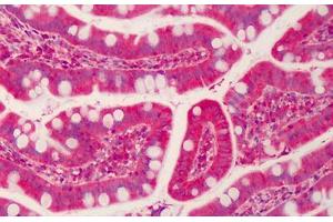 Human Small Intestine: Formalin-Fixed, Paraffin-Embedded (FFPE)