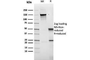 SDS-PAGE Analysis Purified CD14 Recombinant Mouse Monoclonal Antibody (rLPSR/2408).