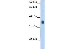 WB Suggested Antibody Titration:  2.