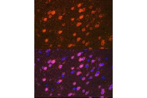 Immunofluorescence analysis of mouse brain cells using TBR1 Rabbit mAb (ABIN7270703) at dilution of 1:100 (40x lens).