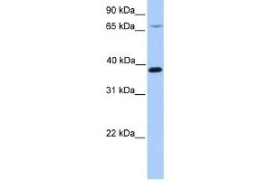 HMBS antibody used at 1 ug/ml to detect target protein. (HMBS anticorps  (N-Term))