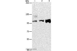 Western blot analysis of A431, 293T and hela cell, using ASCC2 Polyclonal Antibody at dilution of 1:500 (ASCC2 anticorps)