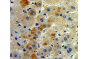 Used in DAB staining on fromalin fixed paraffin-embedded Liver tissue (FAS anticorps  (AA 22-169))