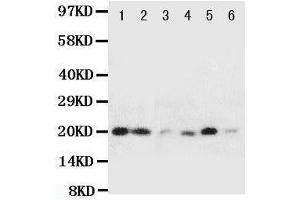 Western Blotting (WB) image for anti-Heat Shock 27kDa Protein 2 (HSPB2) (AA 102-118), (Middle Region) antibody (ABIN3044185)