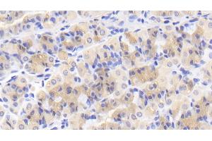 Detection of CASP2 in Human Stomach Tissue using Polyclonal Antibody to Caspase 2 (CASP2) (Caspase 2 anticorps  (AA 334-452))