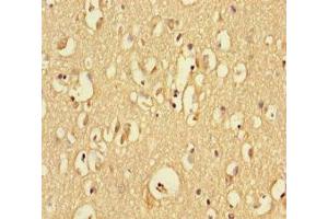 Immunohistochemistry of paraffin-embedded human brain tissue using ABIN7167749 at dilution of 1:100 (RTN4RL1 anticorps  (AA 201-420))