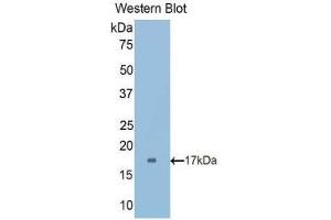 Western Blotting (WB) image for anti-Cubilin (Intrinsic Factor-Cobalamin Receptor) (CUBN) (AA 3157-3274) antibody (ABIN1175677) (CUBN anticorps  (AA 3157-3274))