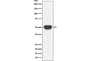 Western blot analysis of PTP1B expression in HeLa cell lysate.