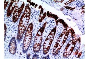 Immunohistochemistry (IHC) analysis of paraffin-embedded Human Colon, antibody was diluted at 1:100.