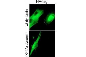 GTPase activity of dynamin-2 is required for endocytosis of cell-surface tTG. (HA-Tag anticorps)