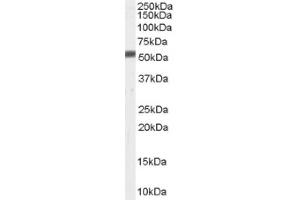 Image no. 1 for anti-Zinc Metalloproteinase, Ste24 (Zmpste24) (C-Term) antibody (ABIN374738) (ZMPSTE24 anticorps  (C-Term))