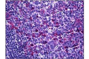 Human Tonsil: Formalin-Fixed, Paraffin-Embedded (FFPE)