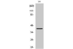 Western Blotting (WB) image for anti-SUMO1 Activating Enzyme Subunit 1 (SAE1) (Internal Region) antibody (ABIN3186870) (SAE1 anticorps  (Internal Region))