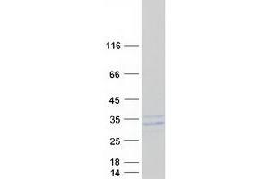 Validation with Western Blot