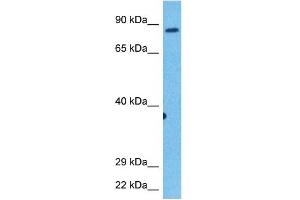 Host:  Rabbit  Target Name:  KIF2C  Sample Tissue:  Human Stomach Tumor  Antibody Dilution:  1ug/ml (KIF2C anticorps  (C-Term))