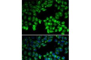 Immunofluorescence analysis of U2OS cells using NEIL1 Polyclonal Antibody