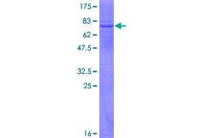 Image no. 1 for Apolipoprotein B mRNA Editing Enzyme, Catalytic Polypeptide-Like 3G (APOBEC3G) (AA 1-384) protein (GST tag) (ABIN1345359)