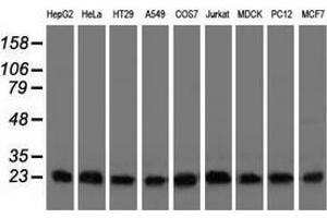 Western blot analysis of extracts (35 µg) from 9 different cell lines by using anti-CLPP monoclonal antibody.