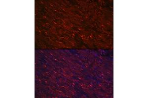 Immunofluorescence analysis of rat heart using PG Rabbit pAb (ABIN6132481, ABIN6145500, ABIN6145501 and ABIN6223912) at dilution of 1:100 (40x lens). (PGAM2 anticorps  (AA 1-253))
