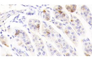 Detection of CHGA in Mouse Stomach Tissue using Polyclonal Antibody to Chromogranin A (CHGA)