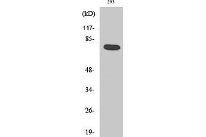 anti-Actinin, alpha 1/2/3/4 (ACTN1/ACTN2/ACTN3/ACTN4) (AA 40-120) antibody