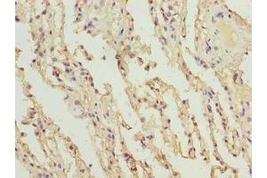 Immunohistochemistry of paraffin-embedded human lung tissue using ABIN7148227 at dilution of 1:100 (COL12A1 anticorps  (AA 140-316))