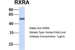 Host:  Rabbit  Target Name:  RXRA  Sample Type:  Human Fetal Liver  Antibody Dilution:  1. (Retinoid X Receptor alpha anticorps  (N-Term))
