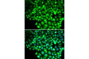 Immunofluorescence analysis of HeLa cells using ALOX15B antibody. (ALOX15B anticorps)