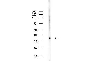 Western blot analysis of lysates from F10-LUC cells(UV,30 min treatment), using cbx7 Antibody at 1/1000 dilution.