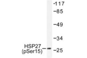 Image no. 1 for anti-Heat Shock 27kDa Protein 1 (HSPB1) (pSer15) antibody (ABIN318042) (HSP27 anticorps  (pSer15))