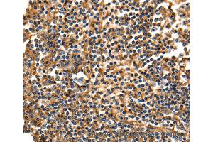 Immunohistochemistry of Human tonsil using ANXA5 Polyclonal Antibody at dilution of 1:40 (Annexin V anticorps)