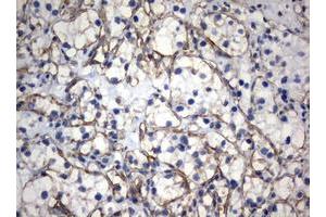 Image no. 3 for anti-Vimentin (VIM) (AA 210-466) antibody (ABIN1491200)