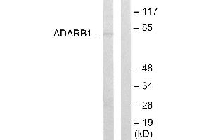 Western blot analysis of extracts from HepG2 cells, using ADARB1 antibody. (RED1 anticorps)