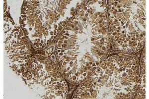 ABIN6277667 at 1/100 staining Mouse testis tissue by IHC-P. (TPP1 anticorps  (Internal Region))