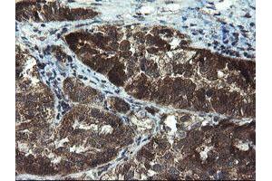 Image no. 8 for anti-Tubulin Folding Cofactor C (TBCC) antibody (ABIN1501323)