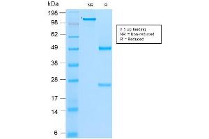 SDS-PAGE Analysis of Purified MyoD1 Mouse Recombinant Monoclonal Antibody ABIN6383887.