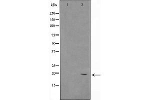 Western blot analysis of ASH2 using 293 whole cell lysates (ASH2L anticorps  (Internal Region))
