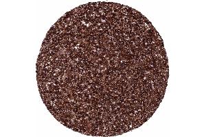 Lymph node Diffuse large B cell lymphoma with intense IgD immunostaining of tumor cells (Recombinant IgD anticorps)