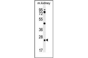 Western blot analysis of PGPEP1 Antibody (N-term) in mouse kidney tissue lysates (35ug/lane). (PGPEP1 anticorps  (N-Term))