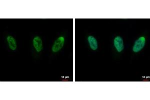 ICC/IF Image CIP29 antibody [N1C3] detects CIP29 protein at nucleus by immunofluorescent analysis. (SARNP anticorps)