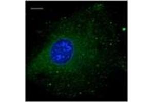 Immunofluorescence — anti-Rab5b Ab using B6-RPE07 cells at 1/100 dilutlon; (RAB5B anticorps  (C-Term))