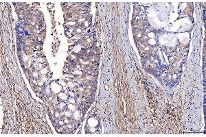 IHC analysis of ENO1 using anti-ENO1 antibody (ABIN7601902). (ENO1 anticorps  (AA 50-250))