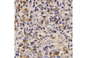 Immunohistochemistry (IHC) image for anti-ATP-Binding Cassette, Sub-Family A (ABC1), Member 6 (ABCA6) antibody (ABIN1870712) (ABCA6 anticorps)