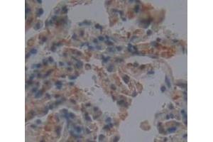 IHC-P analysis of Human Tissue, with DAB staining. (CLEC3B anticorps  (AA 22-202))