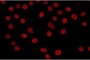 ABIN6266650 staining LOVO by IF/ICC.